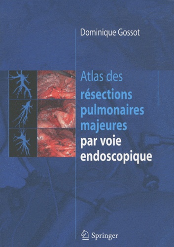 Dominique Gossot - Atlas des résections pulmonaires majeures par voie endoscopique.