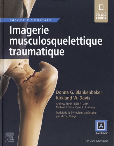 Imagerie musculosquelettique traumatique