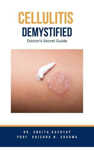  Dr. Ankita Kashyap et  Prof. Krishna N. Sharma - Cellulitis Demystified: Doctor's Secret Guide.