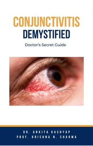  Dr. Ankita Kashyap et  Prof. Krishna N. Sharma - Conjunctivitis Demystified: Doctor’s Secret Guide.