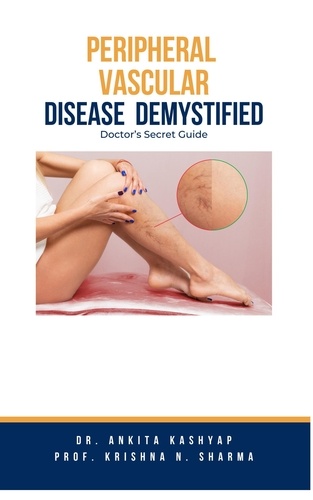  Dr. Ankita Kashyap et  Prof. Krishna N. Sharma - Peripheral Vascular Disease Demystified: Doctor's Secret Guide.