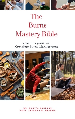  Dr. Ankita Kashyap et  Prof. Krishna N. Sharma - The Burns Mastery Bible: Your Blueprint for Complete Burns Management.