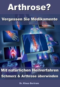 Arthrose? – Vergessen Sie Medikamente – Mit natürlichen Heilverfahren Schmerz &amp; Arthrose überwinden