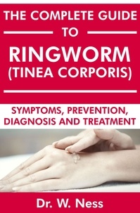  Dr. W. Ness - The Complete Guide to Ringworm (Tinea Corporis): Symptoms, Prevention, Diagnosis and Treatment.