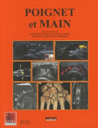 Poignet et main
