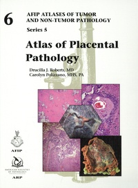 Drucilla J. Roberts et Carolyn Polizzano - Atlas of Placental Pathology.