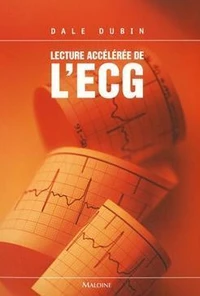 Lecture Accélérée de L'ECG