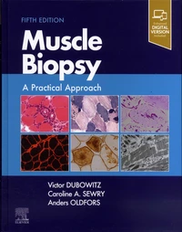 Muscle Biopsy