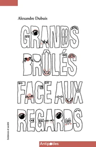 Grands brûlés face aux regards