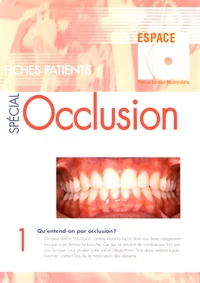 100 Fiches patients spécial occlusion