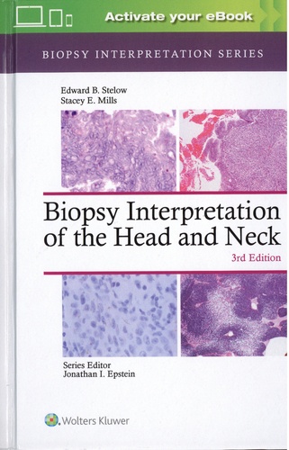 Edward B. Stelow et Stacey Mills - Biopsy Interpretation of the Head and Neck.