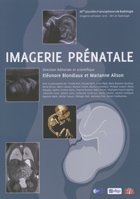 Eléonore Blondiaux et Marianne Alison - Imagerie prénatale.