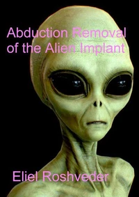 Abduction Removal of the Alien Implant