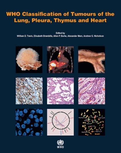 Who Classification of Tumours of the Lung, Pleura, Thymus and Heart 4th edition