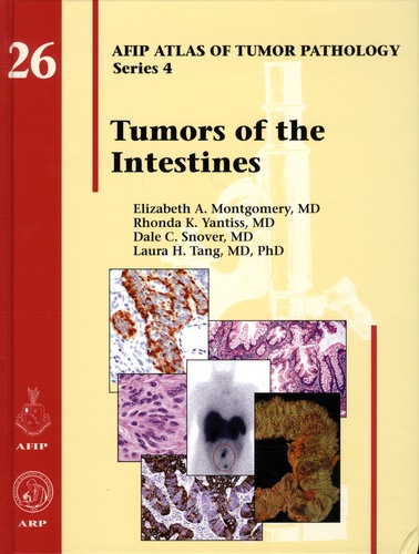 Elizabeth-A Montgomery et Rhonda-K Yantiss - AFIP Atlas of Tumor Pathology - Fourth Series Fascicle 26, Tumors of the Intestines.