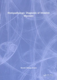 Histopathologic Diagnosis of Invasive Mycoses