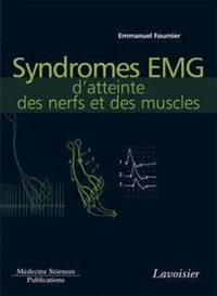 Syndromes EMG d'atteinte des nerfs et des muscles