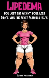 Lipedema: You Lost the Weight. Your Legs Didn't. Why and What Actually Helps.