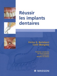 Enrico G Bartolucci et Carlo Mangano - Réussir les implants dentaires.