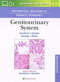 Differential Diagnoses in Surgical Pathology: Genitourinary System