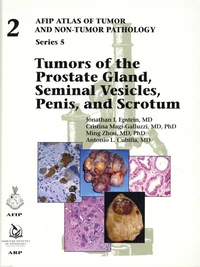 Tumors of the Prostate Gland, Seminal Vesicles, Penis, and Scrotum