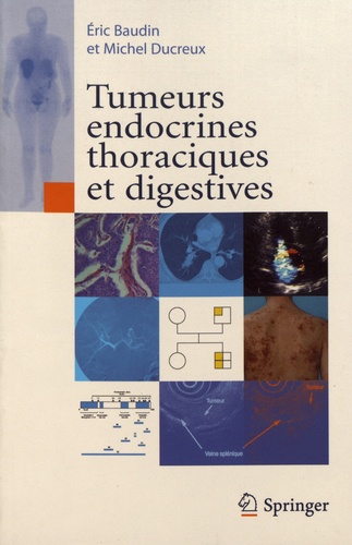 Eric Baudin et Michel Ducreux - Tumeurs endocrines thoraciques et digestives.