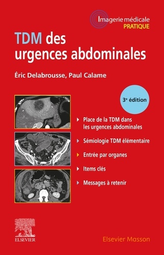TDM des urgences abdominales 3e édition