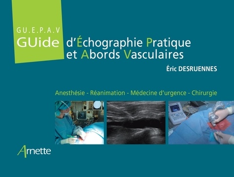 GU.E.P.A.V Guide d'échographie pratique et abords vasculaires