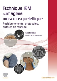 Téléchargement gratuit de magazines ebooks pdf Technique IRM en imagerie musculosquelettique  - Positionnement, protocoles, critères de réussite 9782294782114