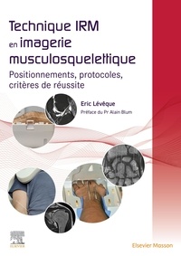 Téléchargements gratuits de livres en français Technique IRM en imagerie musculosquelettique  - Positionnement, protocoles, critères de réussite par Eric Lévêque, Alain Blum (French Edition) PDF 9782294782114