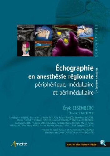 Echographie en anesthésie régionale périphérique, médullaire et périmédullaire 3e édition revue et augmentée