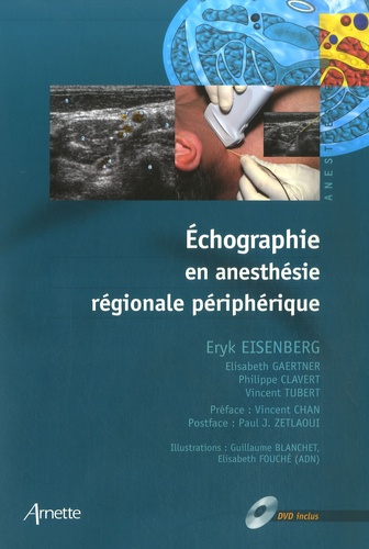 Eryk Eisenberg et Elisabeth Gaertner - Echographie en anesthesie régionale périphérique. 1 DVD