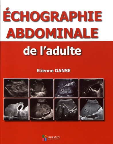 Echographie abdominale de l'adulte