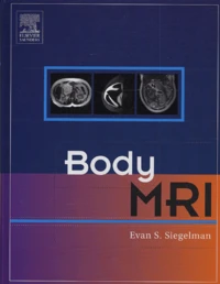 Body MRI
