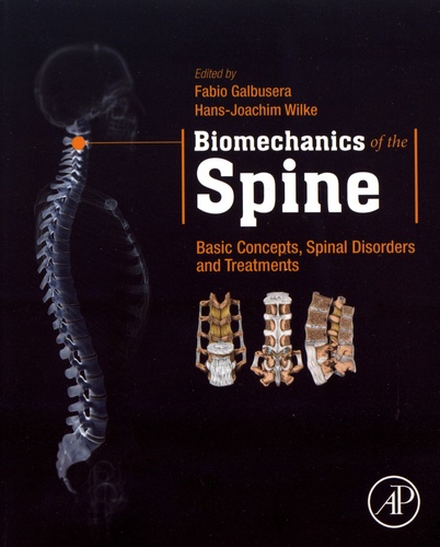 Biomechanics of the Spine. Basic Concepts, Spinal Disorders and Treatments