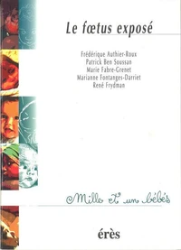 Le foetus exposé