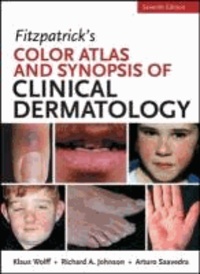 Fitzpatrick's Color Atlas and Synopsis of Clinical Dermatology.