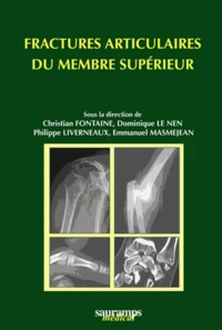 Fractures articulaires du membre supérieur