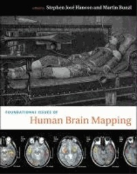 Foundational Issues in Human Brain Mapping.