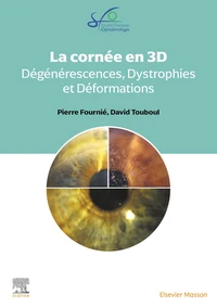 La cornée en 3D