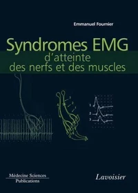 Syndromes EMG d'atteinte des nerfs et des muscles