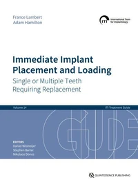 Immediate Implant Placement and Loading – Single or Multiple Teeth Requiring Replacement