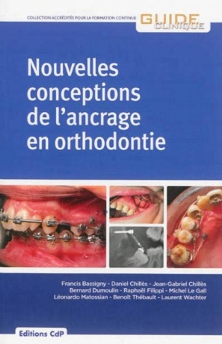 Francis Bassigny et Daniel Chillès - Nouvelles conceptions de l'ancrage en orthodontie.