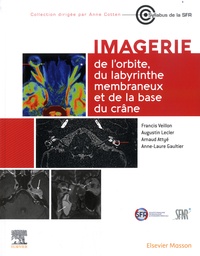 Francis Veillon et Augustin Lecler - Imagerie de l'orbite, du labyrinthe membraneux et de la base du crâne.