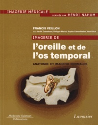 Francis Veillon - Imagerie de l'oreille et de l'os temporal - Tome 1, Anatomie et imagerie normales.