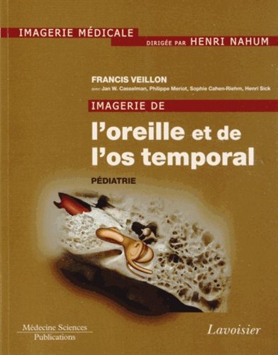 Francis Veillon - Imagerie de l'oreille et de l'os temporal - Tome 5, Pédiatrie.