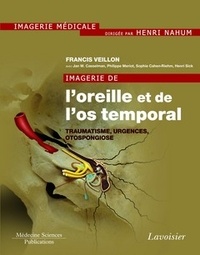 Francis Veillon - Imagerie de l'oreille et de l'os temporal - Tome 3, Traumatologie, urgences, otospongiose.