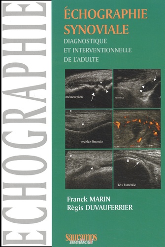 Franck Marin et Régis Duvauferrier - Echographie Synoviale Diagnostique Et Interventionnelle De L'Adulte.