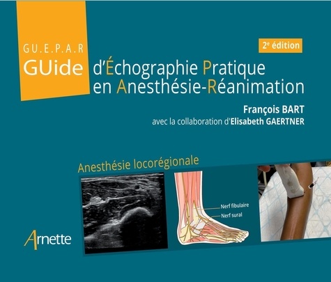 François Bart et Elisabeth Gaertner - Guide d'échographie pratique en anesthésie-réanimation.