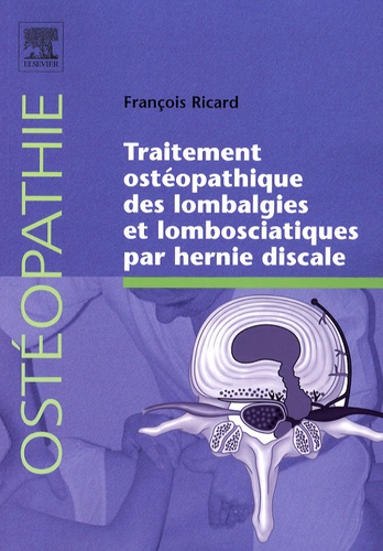 François Ricard - Traitement ostéopathique des lombalgies et lombosciatiques par hernie discale.